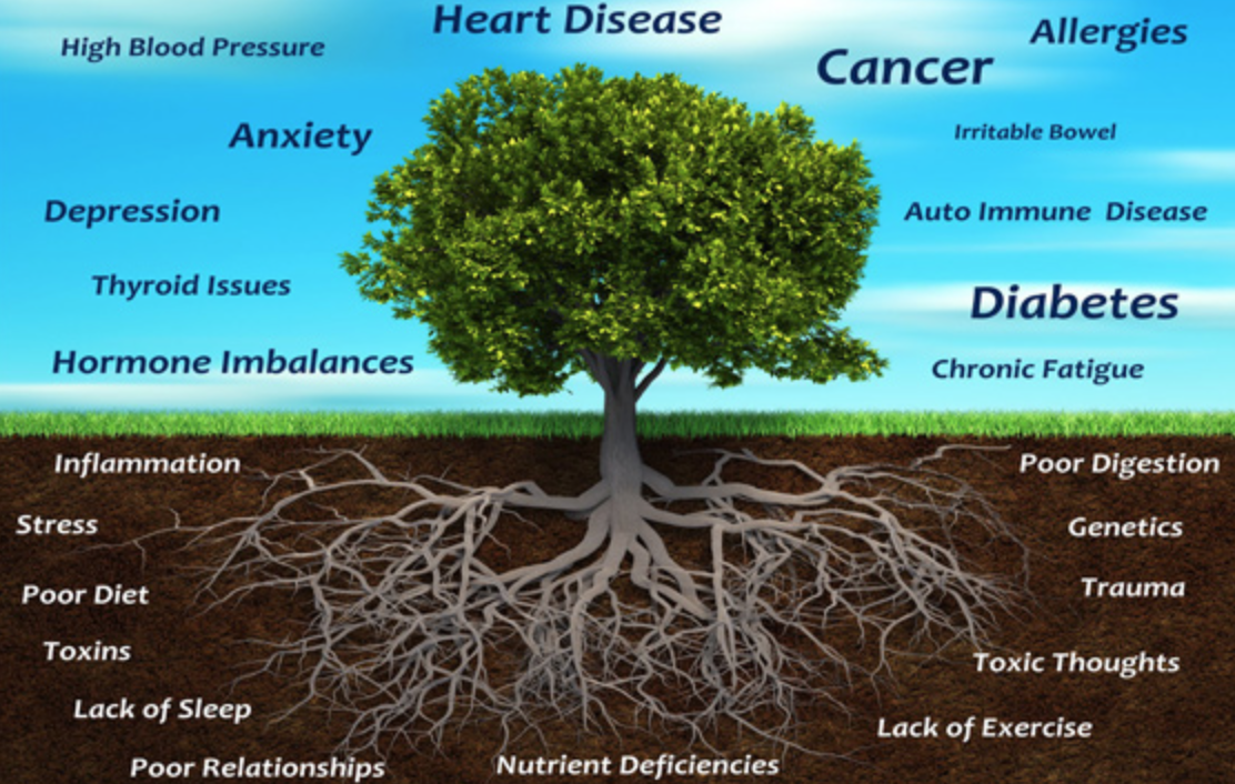 Tree diagram